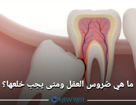 ما هي ضروس العقل