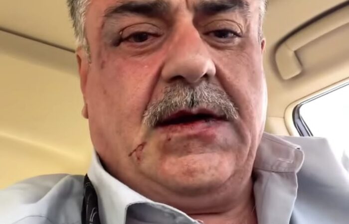 هێزێک لە هەولێر ئەشکەنجەی یاساناسێک دەدەن