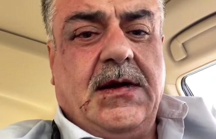 ئەم کارە بەڵتەچێتییە
