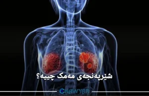 شێرپەنجەی مەمک چییه