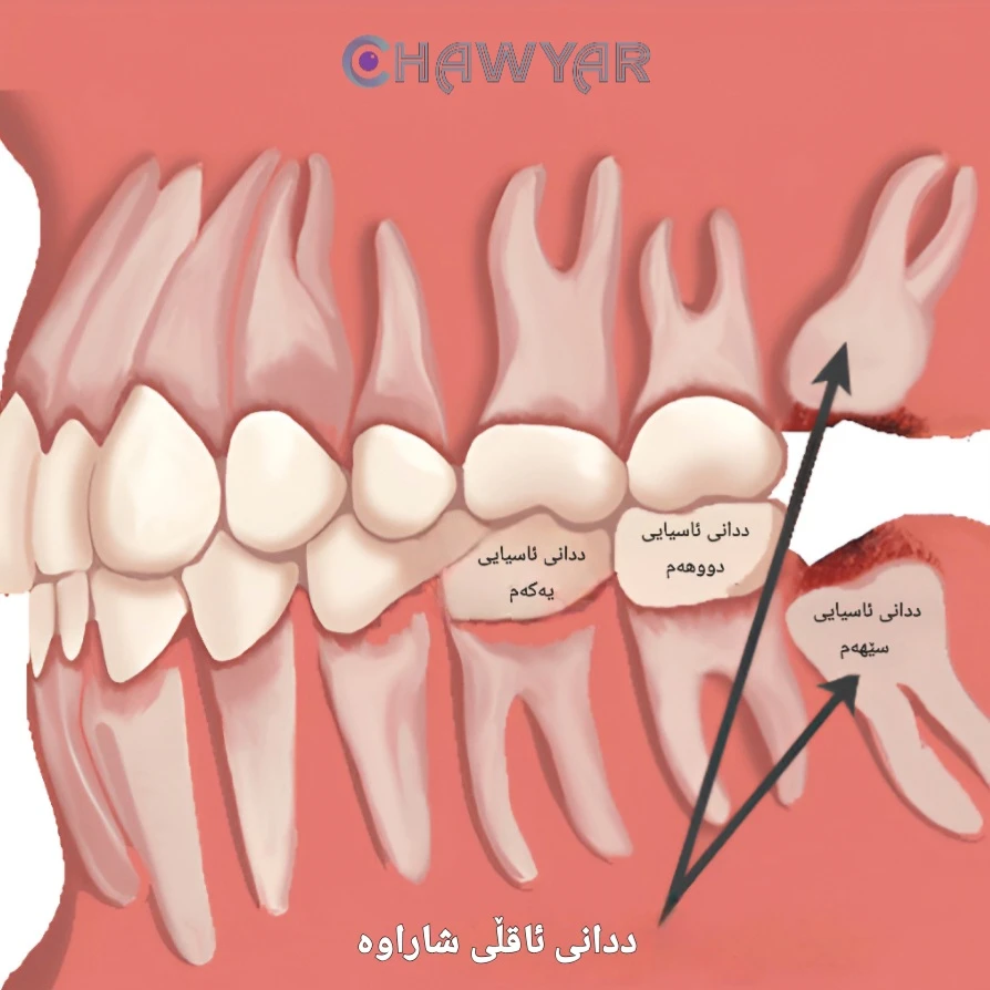 ددانی ئاقڵی شاراوە