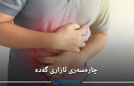 چارەسەری ئازاری گەدە