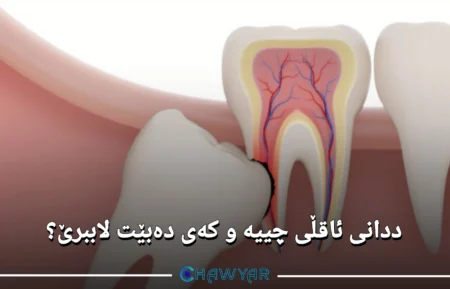 ددانی ئاقڵی چییە