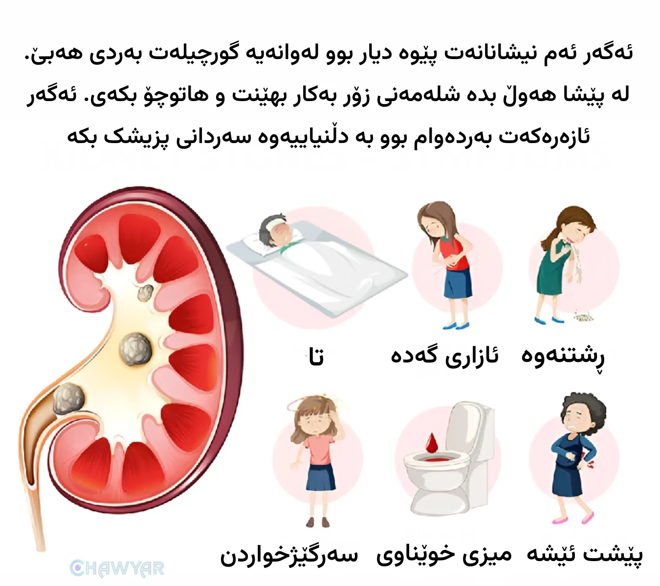 نیشانەکانی بەردی گورچیلە