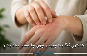 هۆکار و چارەسەری ئەگزیما